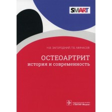 Osteoarthritis: History and modernity. Zagorodniy Nikolay Vasilievich