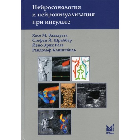 Neurosonology and neuroizualization for stroke. 2nd edition. Valdueza H.M., Shreiber S.I., rail J.-E., Klinbil R.