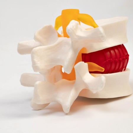 Lock "Intervertebral disc" 11*10*8cm-4