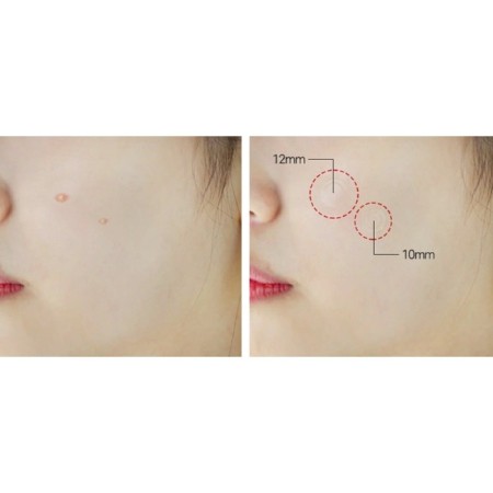 Patch mask for problem skin AC Clear Spot Patch 24pcs-1