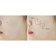 Patch mask for problem skin AC Clear Spot Patch 24pcs