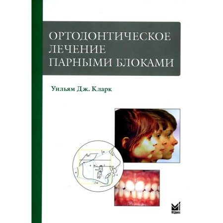 Orthodontic treatment with paired blocks. 3rd edition. Clark U.J.