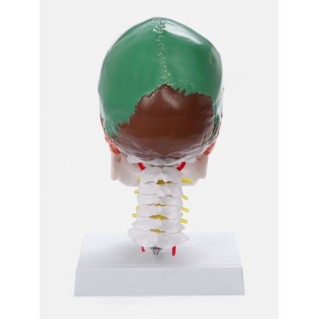 Matcage "Skull with the brain" Disassembly 27*19*12cm-3