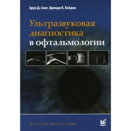 Ultrasound diagnosis in ophthalmology. 2nd edition. Sing A.D.