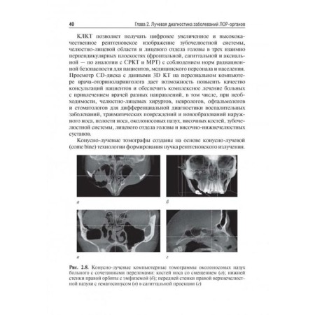 Otorhinolaryngology. under. Ed. Karpishche-10