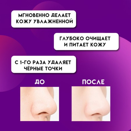 Mask with strips for the nose, cleansing of acne, acne and black dots-1