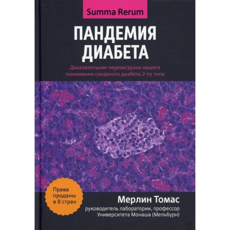 Pandemia of diabetes. Evidence reloading our understanding of type 2 diabetes. Thomas M.