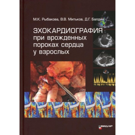Echocardiography with congenital heart defects in adults. Rybakova M.K., Mitkov V.