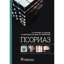Psoriasis. Kruglova L.S., Bakulev A.L., Korotaeva T.V.