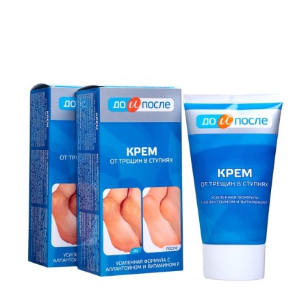 Foot cream "to and after" from cracks in the feet, 2 pcs 150 ml