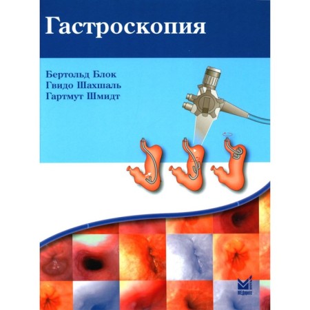 Gastroscopy. 5th edition. Blok B., Shahshal G., Schmidt G.