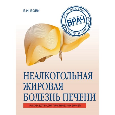 Non -alcoholic fatty liver disease. Vovk E.I.