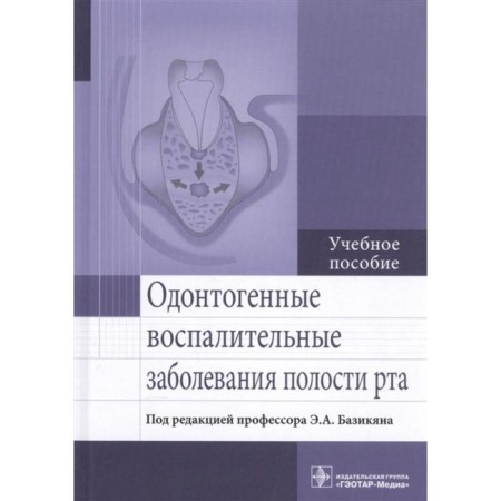Odontogenic inflammatory diseases of the oral cavity
