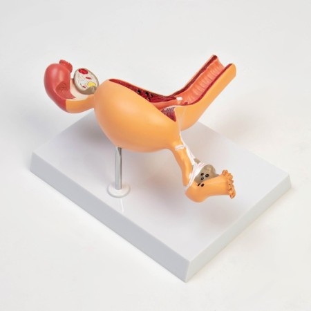 Matcage "Organs of the uterus, pathology" 24*12*20cm-1