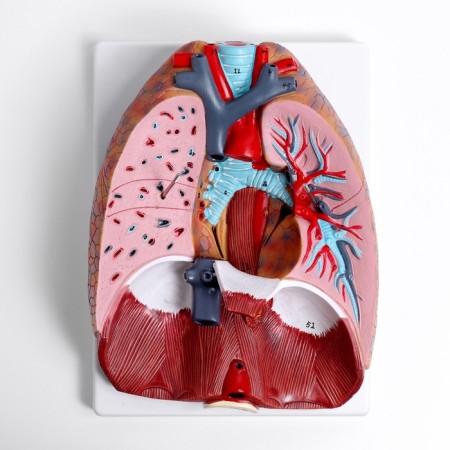 Match "Human breasts" collapsible 27*20*11cm-6