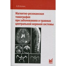 Магнитно-резонансная томография при заболеваниях и травмах центральной нервной системы. 2-е издание. Холин А.В.