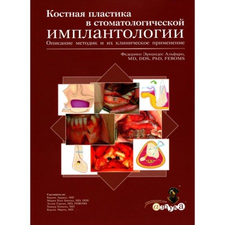 Bone plastic in dental implantology. Description of the techniques and their clinical application. Alfaro F.E.