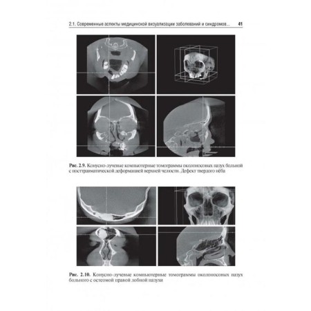 Otorhinolaryngology. under. Ed. Karpishche-11