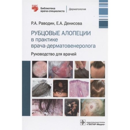 Rickeeper alopecia in the practice of a dermatamatereologist. Guide for doctors. Radan R., Denisova E.